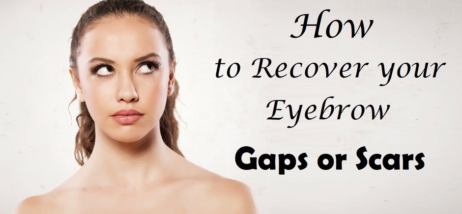 how_to_recover_eyebrow_gaps_or_scars