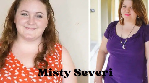 Misty Severi
